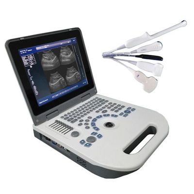 গুণ  TGC Control Notebook Ultrasound Scanner For Pregnancy Home Use কারখানা