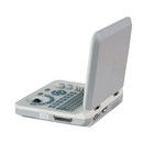 15 ইঞ্চি এলইডি কালার পোর্টেবল আলট্রাসাউন্ড মেশিন, যার স্ক্যানিং অ্যাঙ্গেল 60 ডিগ্রি এবং গভীরতা ≥250মিমি