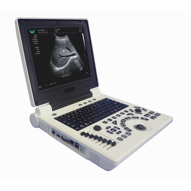 গর্ভাবস্থায় OB GYN পোর্টেবল কালার ডপলার আল্ট্রাসাউন্ড মেশিন
