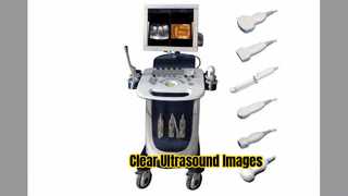 ডপলার আল্ট্রাসাউন্ড স্ক্যানার PW CFM PDI মোড