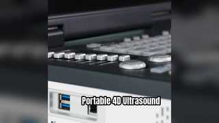 পোর্টেবল 4D ডপলার আল্ট্রাসাউন্ড মেশিন ICU প্রস্তুত