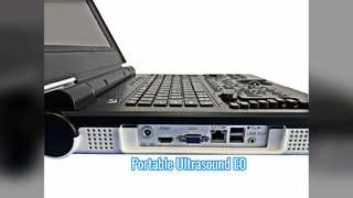 পোর্টেবল কালার ডপলার আল্ট্রাসাউন্ড E0 ইউরোলজি স্ক্যান